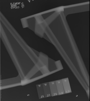 Radiograph